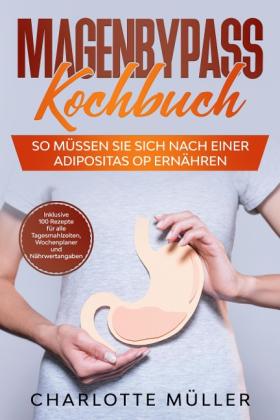Charlotte Müller: Magenbypass Kochbuch: So müssen Sie sich nach einer Adipositas OP ernähren - Inklusive 100 Rezepte für alle Tagesmahlzeiten, Wochenplaner und Nährwertangaben 