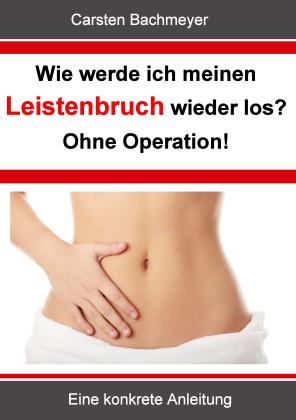 Carsten Bachmeyer: Wie werde ich meinen Leistenbruch wieder los? Ohne Operation! 