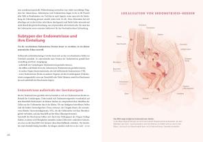 Sylvia Mechsner, Sylvia Prof. Dr. med. Mechsner: Endometriose – Die unterschätzte Krankheit 